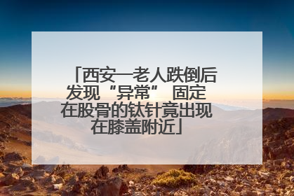 西安一老人跌倒后发现“异常” 固定在股骨的钛针竟出现在膝盖附近